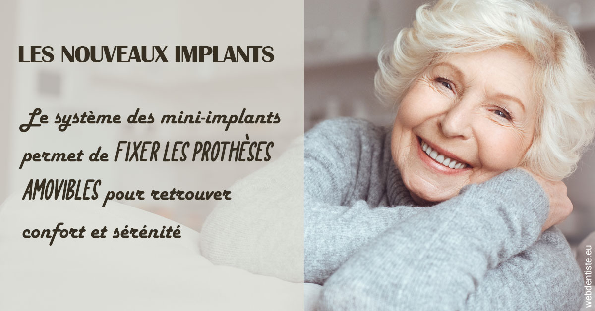 https://dr-romain-gueudin.chirurgiens-dentistes.fr/Les nouveaux implants 1