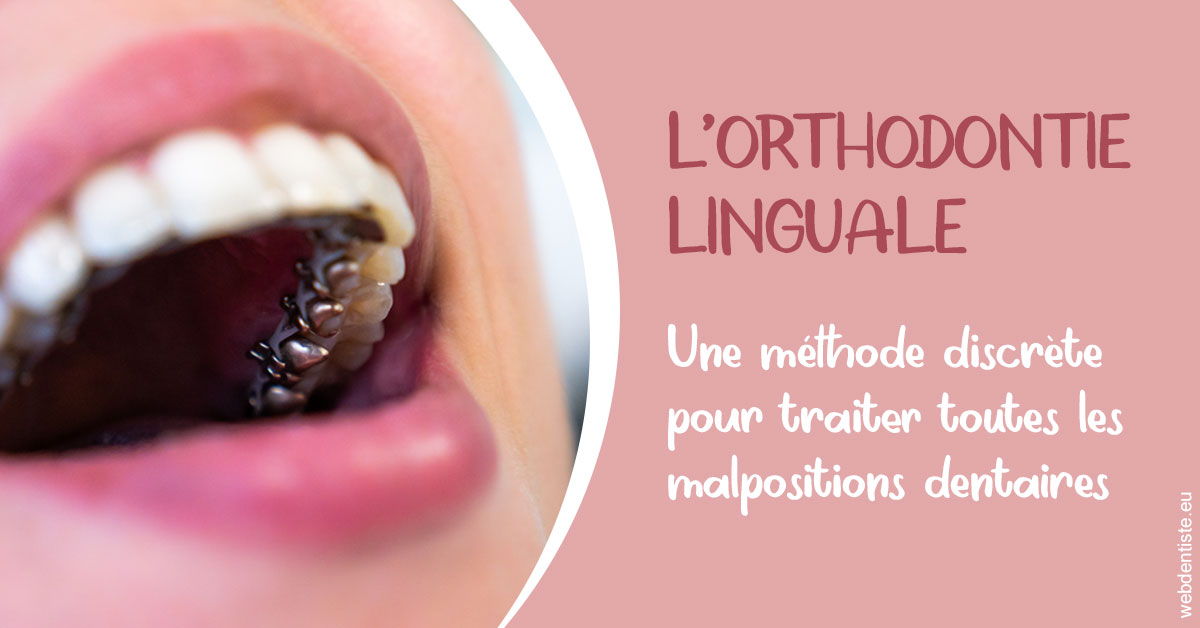 https://dr-romain-gueudin.chirurgiens-dentistes.fr/L'orthodontie linguale 2