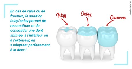 https://dr-romain-gueudin.chirurgiens-dentistes.fr/L'INLAY ou l'ONLAY