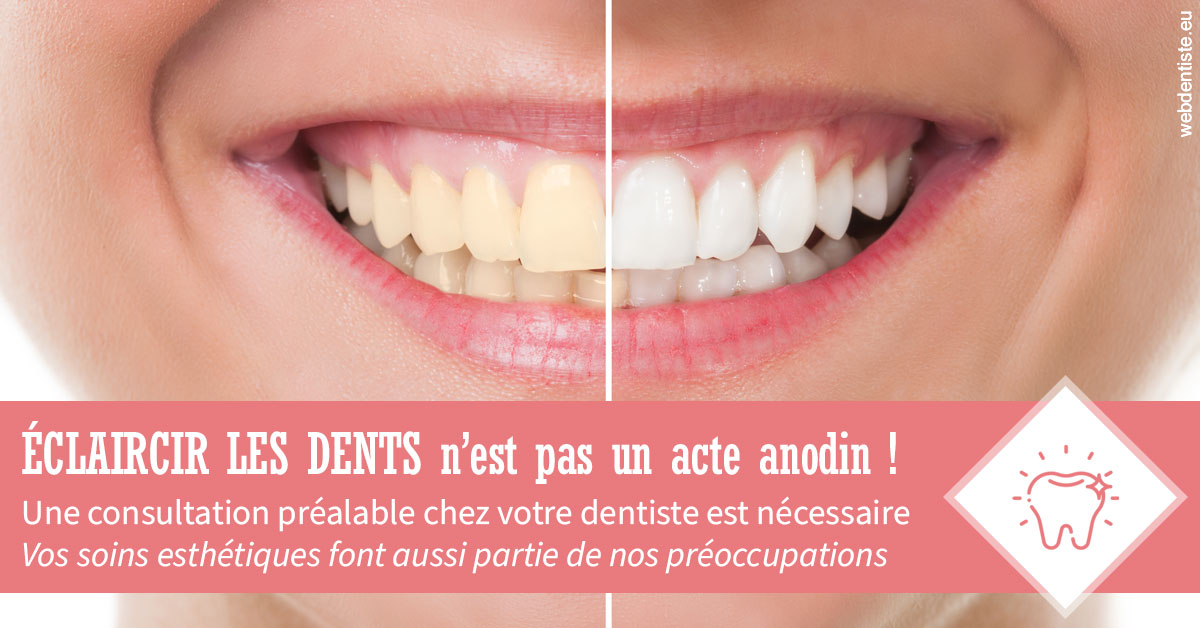 https://dr-romain-gueudin.chirurgiens-dentistes.fr/Eclaircir les dents 1