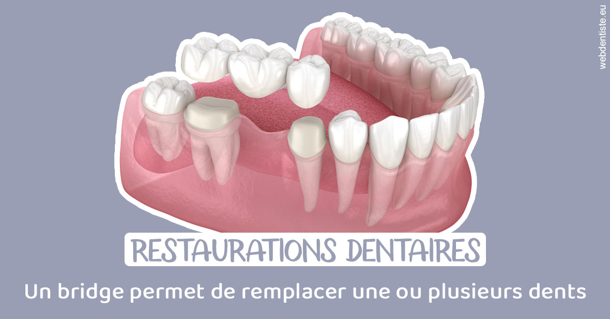 https://dr-romain-gueudin.chirurgiens-dentistes.fr/Bridge remplacer dents 1