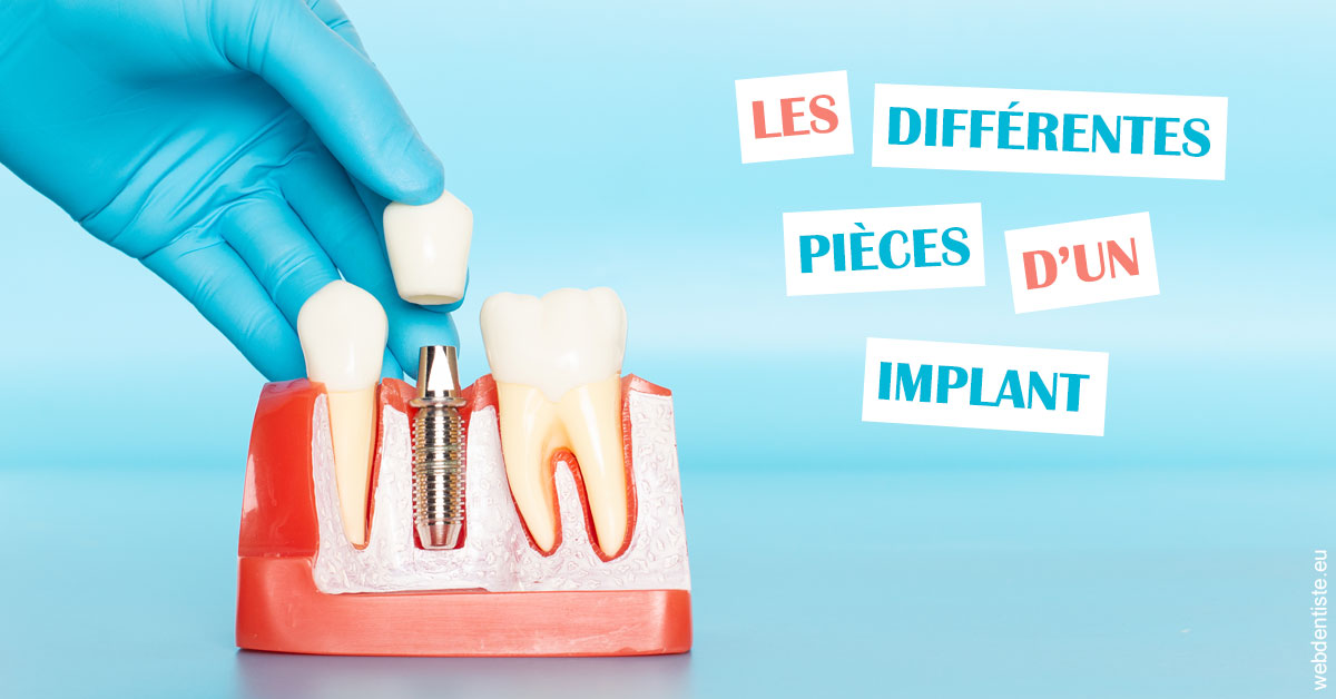 https://dr-romain-gueudin.chirurgiens-dentistes.fr/Les différentes pièces d’un implant 2