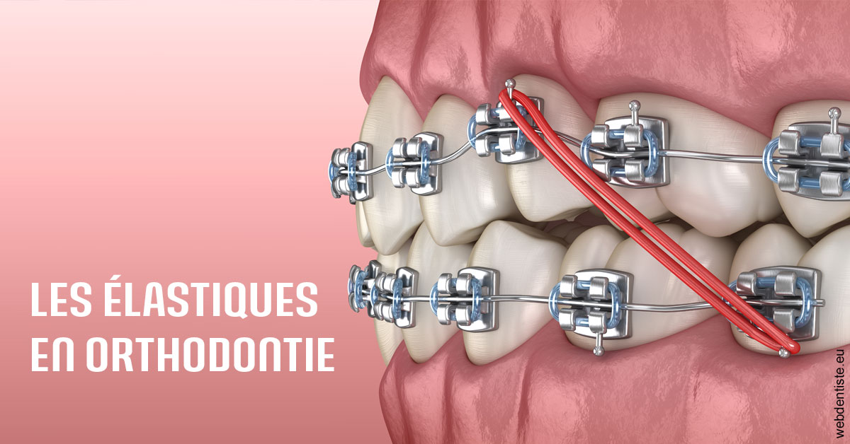 https://dr-romain-gueudin.chirurgiens-dentistes.fr/Elastiques orthodontie 2
