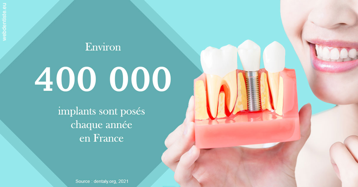 https://dr-romain-gueudin.chirurgiens-dentistes.fr/Pose d'implants en France 2